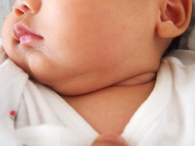 貫禄の首まわり。肉マフラー。